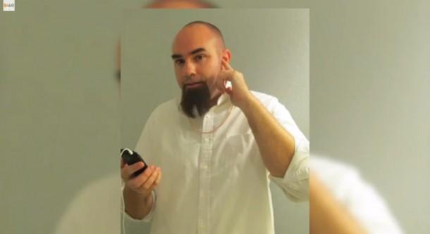 Rich Lee and his implant 3