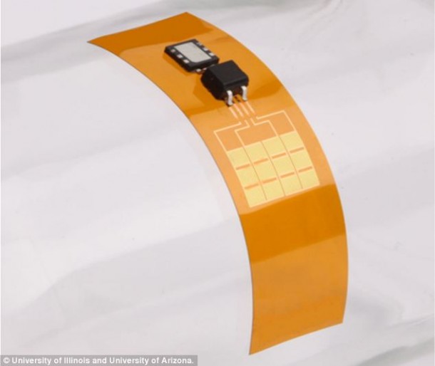 implantable_battery (1)