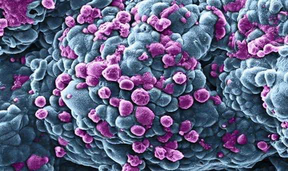 Breast_cancer_cells