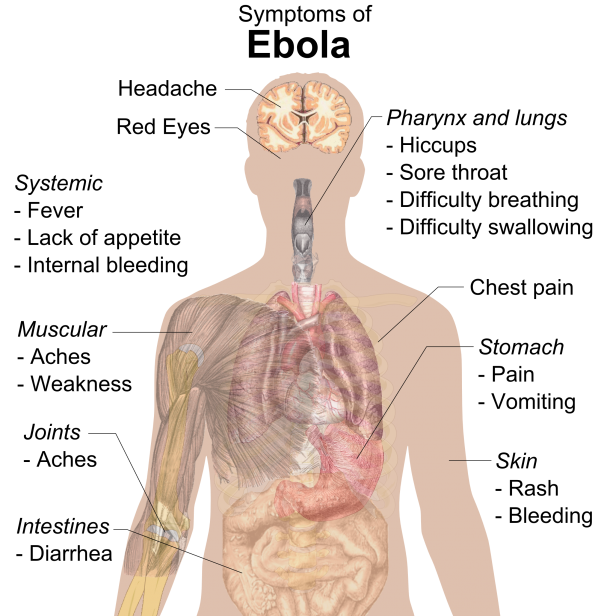 能够诊断埃博拉病毒的智能纸