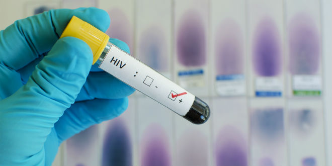 HIV患者Gammora治疗的临床试验