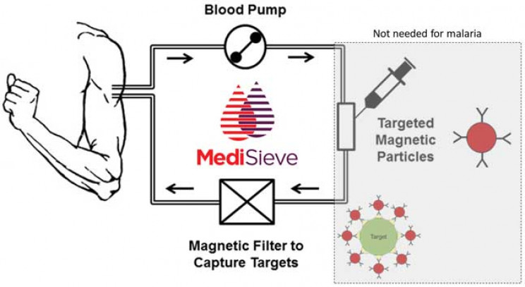 MediSieve可以使用磁铁除去血液疾病