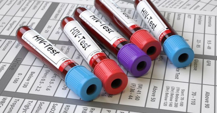 巴西人可能成为第一个治愈艾滋病的药物